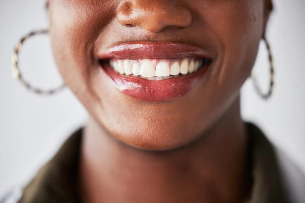 Woman smiling, showing Porcelain Bridges.