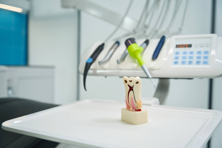 How Much Does a Root Canal Cost in Las Vegas?