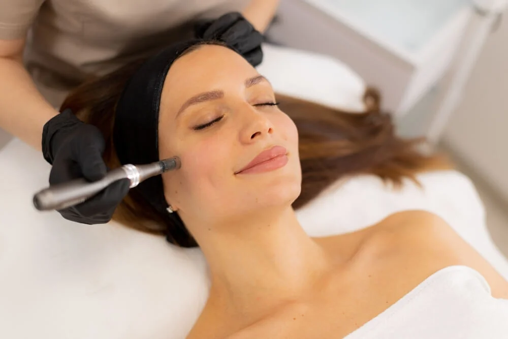 Woman taking microneedling Treatment on her face