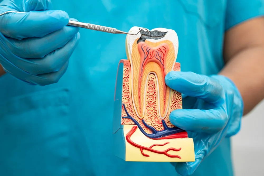 Asian dentist holding dental implant, artificial tooth roots into jaw, root canal of dental treatment, gum disease, teeth model for dentist.