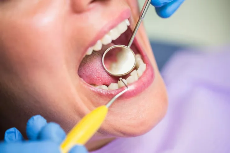 Root Canal vs Extraction: Which Is Right for You?